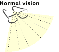 Normal Vision  - no blind spots